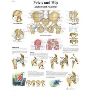 Pelvis and Hip Anatomy and Pathology Laminated Poster  