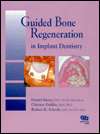 Guided Bone Regeneration in Implant Dentistry, (0867152494), Daniel 