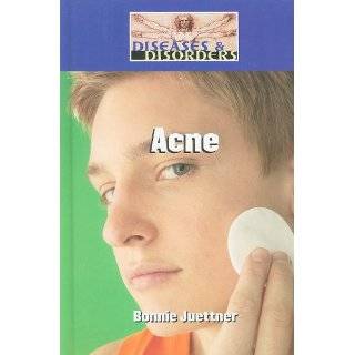 Acne (Diseases & Disorders) by Bonnie Juettner (Feb 1, 2010)