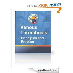 Venous Thrombosis   Principles and Practice Tatjana Pejcic  
