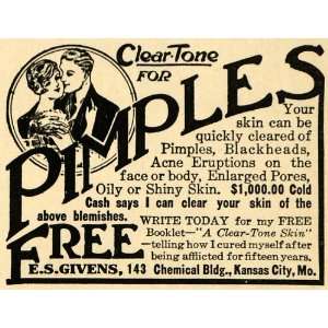  1922 Ad E. S. Givens Clear Tone Pimple Acne Skin Care 