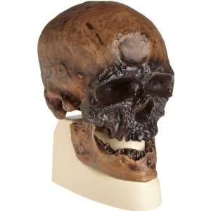 3B Scientific VP752/1 Crô Magnon Anthropological Skull Model, 8.5 x 