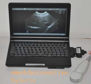 Full Digital Laptop Ultrasound Scanner Machine With Linear Probe 100% 