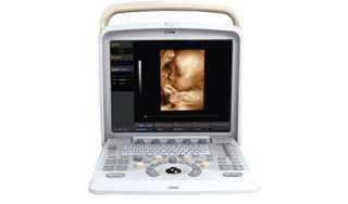 Portable Color Doppler B Ultrasound Ultrasound Scanner convex+linear 2 